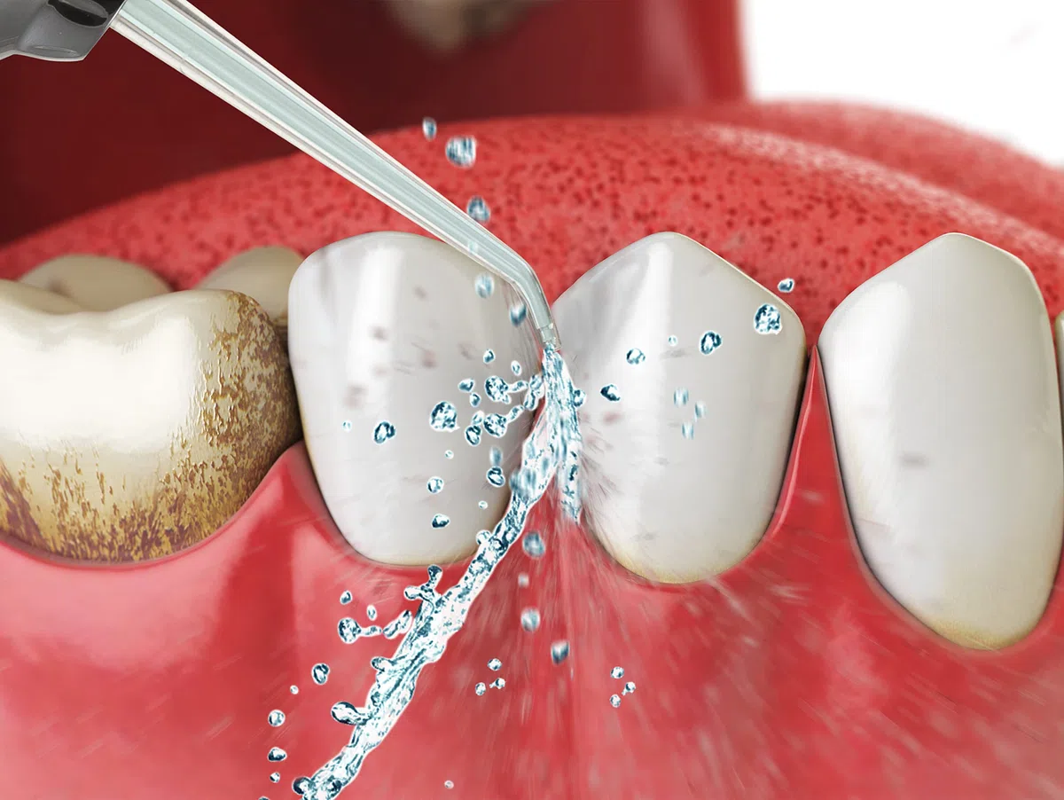 Irrigatore orale portatile per la pulizia dei denti senza fili per la pulizia dei denti dell'acqua portatile FineLife Products ricaricabile e portatile con 3 modalità di pulizia, argento