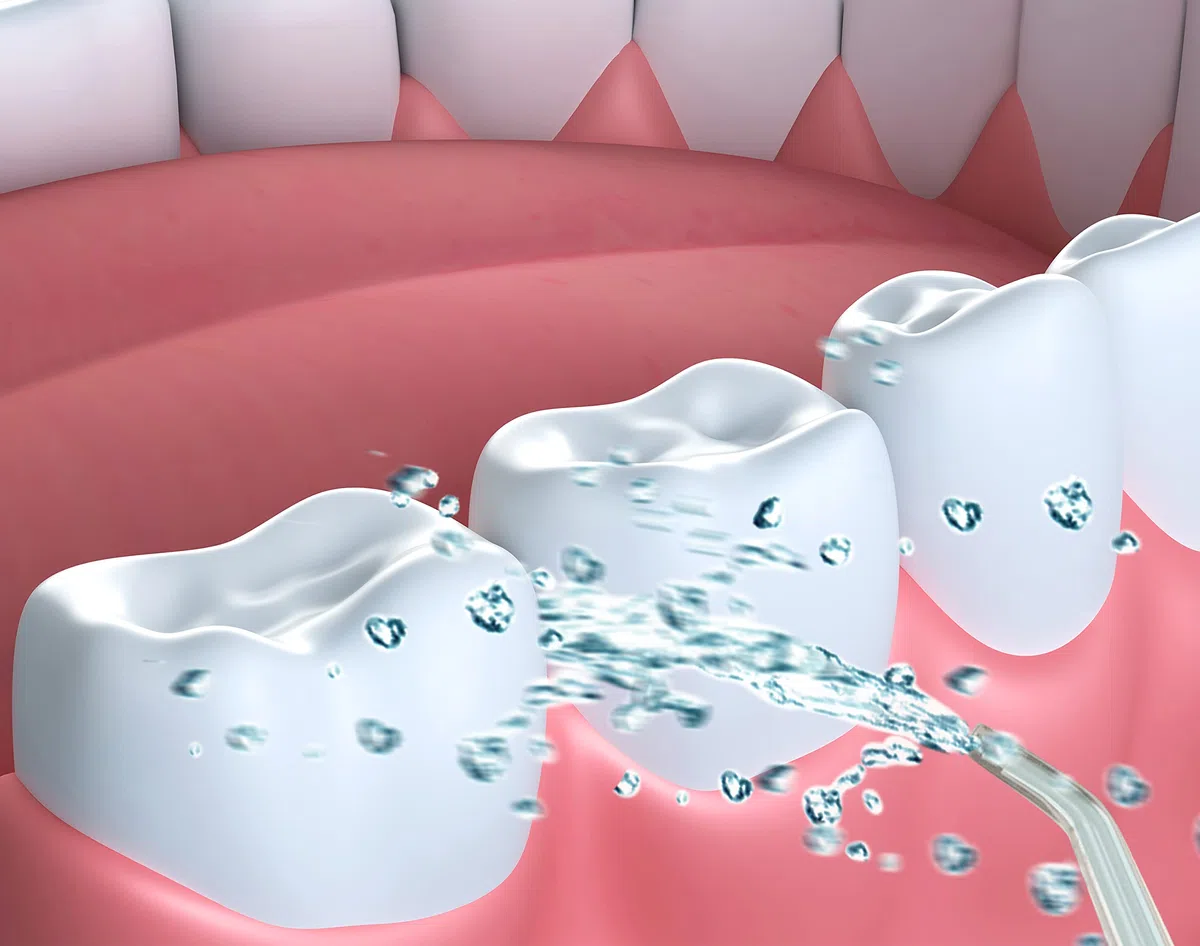 Irrigatore orale portatile per la pulizia dei denti senza fili per la pulizia dei denti dell'acqua portatile FineLife Products ricaricabile e portatile con 3 modalità di pulizia, argento