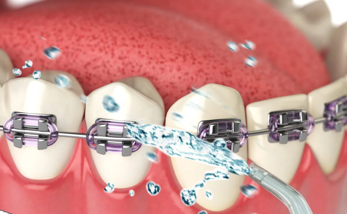 Irrigatore orale portatile per la pulizia dei denti senza fili per la pulizia dei denti dell'acqua portatile FineLife Products ricaricabile e portatile con 3 modalità di pulizia, argento